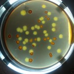 Οι Μεγαλύτερες Πηγές Μικροβίων που Απειλούν την Υγεία σας!